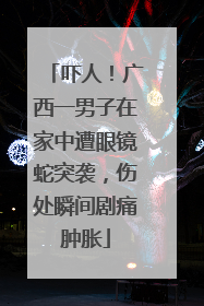 吓人！广西一男子在家中遭眼镜蛇突袭，伤处瞬间剧痛肿胀